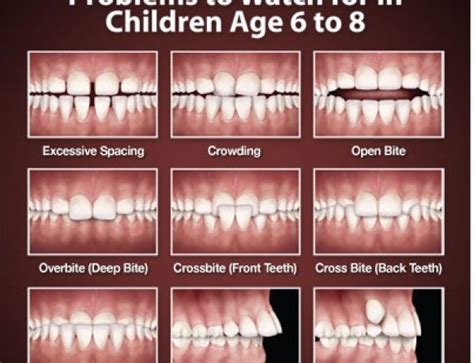 Best Tooth Alignment Centre In Tirunelveli