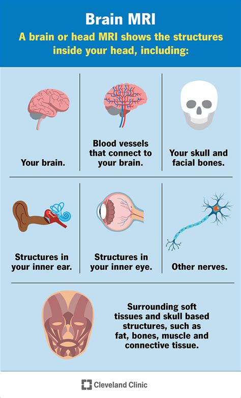 Top 18 what is an mri scan used to diagnose 2022