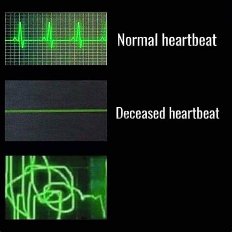 Heartbeat Blank Template - Imgflip