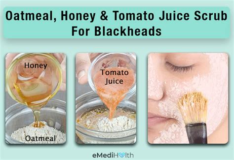 Home Remedies for Blackheads - Navtarang