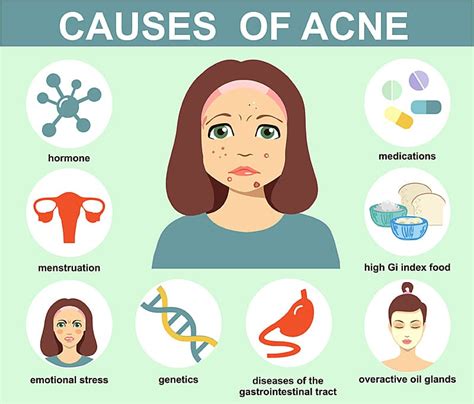 What Causes Cystic Acne And How To Treat It Effectively | SL Aesthetic ...