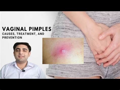 vagina pimples- causes ,treatment, and prevention - YouTube