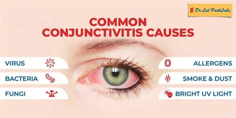 Conjunctivitis: Causes, Symptoms, and Types | Dr. Lal PathLabs