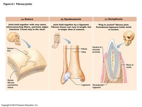 Types Of Fibrous Joints