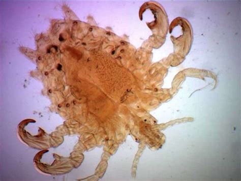 Crab Infection In Wound at Bryan Bailey blog