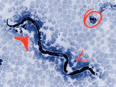 How To Prevent Parasitic Infections - Resortanxiety21