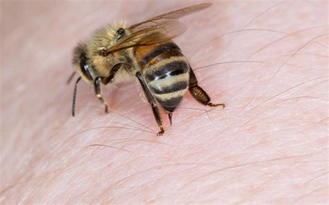 Blog - Home Remedy For Bee Stings