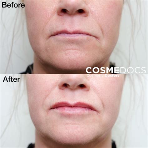 - Cosmedocs