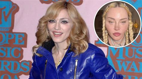 What Happened to Madonna’s Face? A Look into Her Plastic Surgery as ...