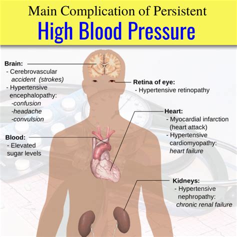 High Blood Pressure Home Remedies | 5 Proven Ways To Lower It