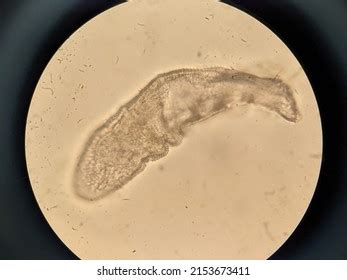 Photo Demodex Face Mites Under Microscope Stock Photo 2153673411 ...