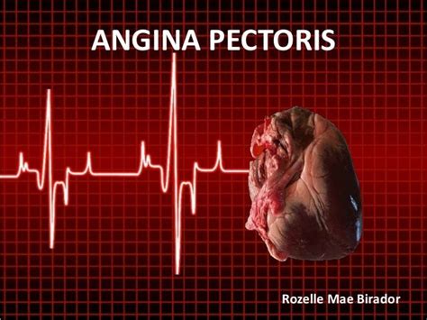 Angina Pectoris