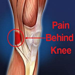 5 Pain Behind Knee Causes with Relief Tips