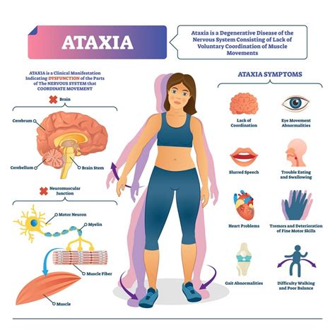 Cerebellar Ataxia and Exercise – Vision Health