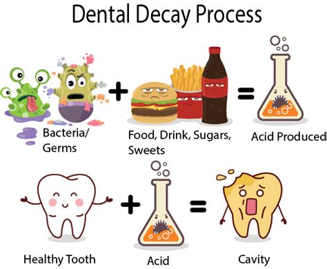 Prevent Dental Decay | Smile Humboldt