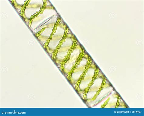 Spirogyra Sp. Algae Under Microscopic View X40, Chlorophyta, Green ...