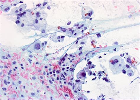 Digestive system cytology | Atlas of Pathology