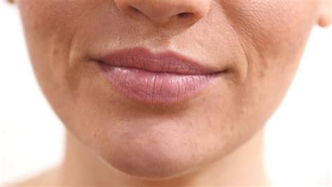 Wrinkles around the mouth? Follow these dermatologist tips | Magazine ...