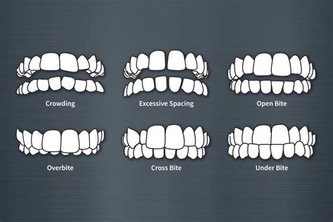 Crooked Teeth