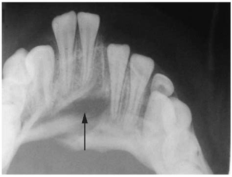 Craniofacial Injury | Anesthesia Key