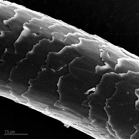 21+ Human Hair In Microscope - IsabelReive