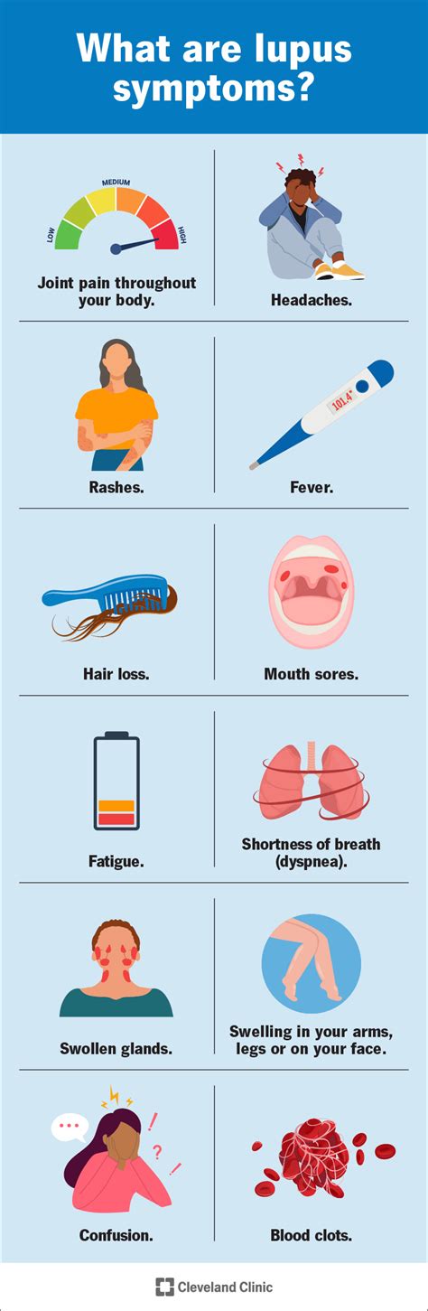 Lupus: Symptoms & Treatment