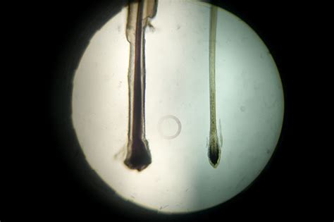 Human Hair Root Under Microscope Hairs Under The Microscope Stock Photo ...