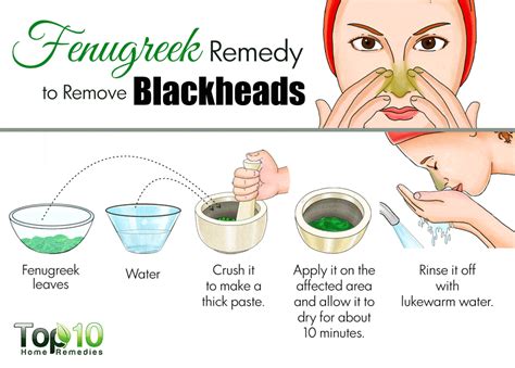 Home Remedies to Get Rid of Blackheads Fast | Top 10 Home Remedies