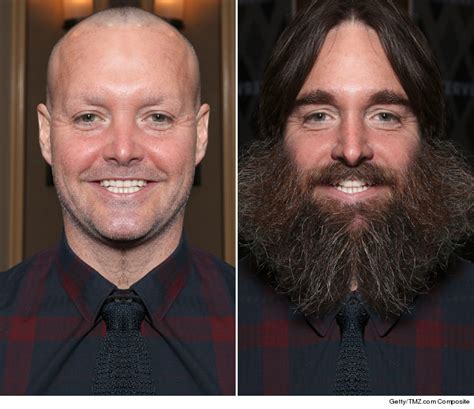 Will Forte's Goofy Growth -- 9 Funny Follicle Mixups | TMZ.com