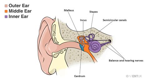 Mastoid Surgery / Cholesteatoma - UPDATE | ENT UK