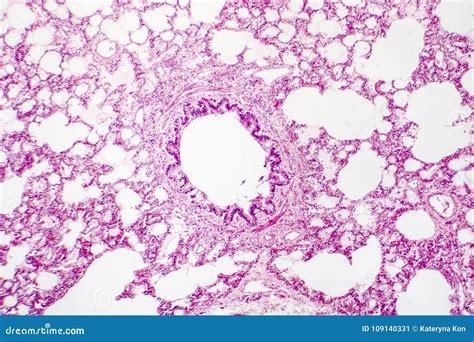 Cross-section of Human Lung Tissue Showing Bronchiole and Alveoli Stock ...