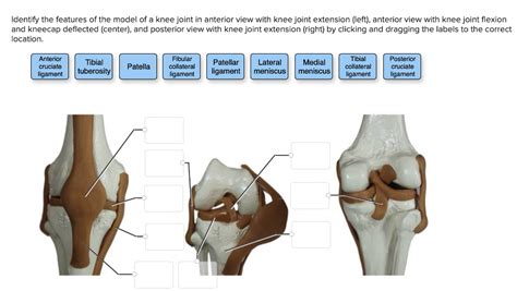 Solved Identify the features of the model of a knee joint in | Chegg.com