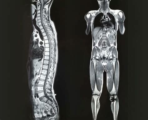 Whole body MRI examination – Medicover