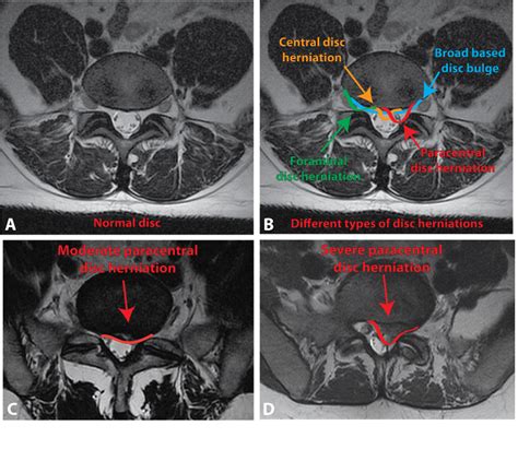 %%sitename%% %%title%% in 2023 | Radiology imaging, Mri, Magnetic ...