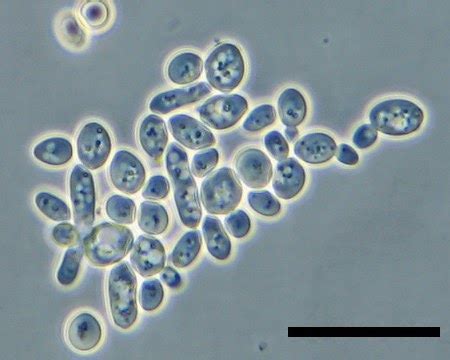 Microscope World Blog: Kids Science Microscope Activity: Yeast