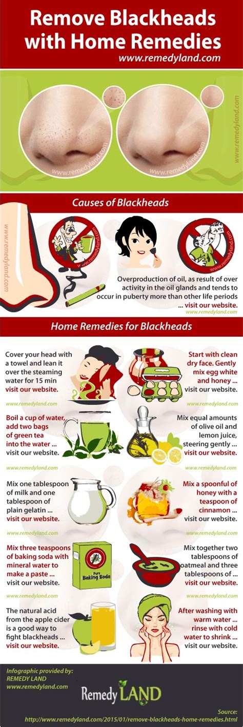 Remove Blackheads with Home Remedies - Remedy Land