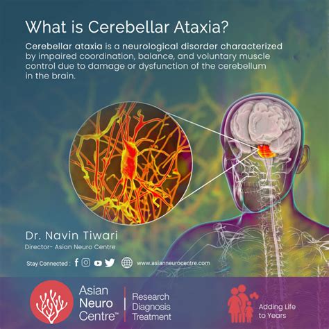 What is Cerebellar Ataxia?, Symptoms, Causes, Treatment & More