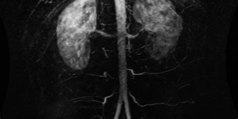 MRI vs MRA - Difference and Comparison | Diffen