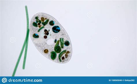 Frontonia Sp. Unicellular Ciliate Protists Under the Microscope. Stock ...