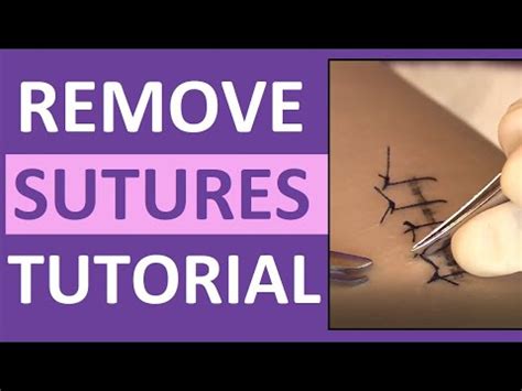 Suture Removal Nursing Skill | How to Remove Surgical Sutures (Stitches ...