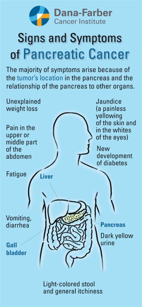 Pancreatic Cancer Symptoms | Dana-Farber Cancer Institute