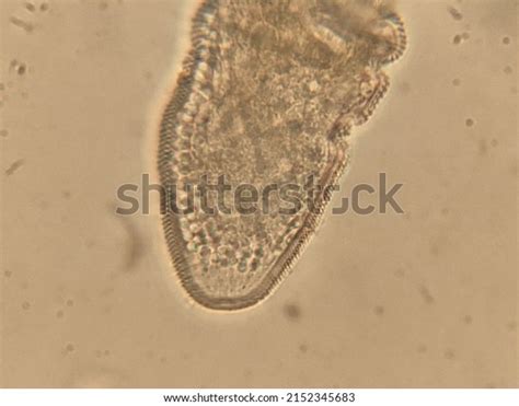 Photo Demodex Face Mites Under Microscope Stock Photo 2152345683 ...