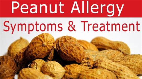 Peanut Allergy - Causes, Reaction, Signs, Symptoms & Treatment