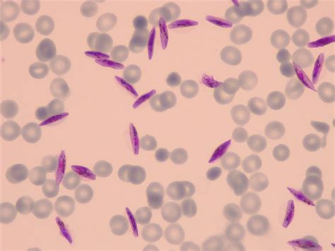 New understanding of parasite biology might help stop malaria transmission