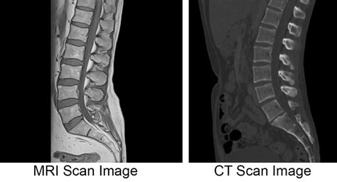 What Is A Ct Scan Look Like