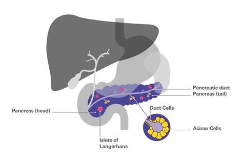 Types of pancreatic cancer - Pancreatic Cancer UK