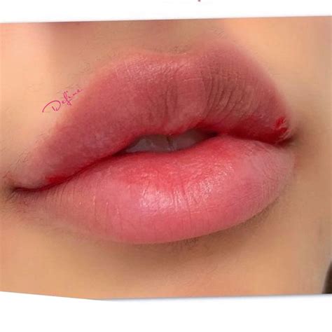 Get The Perfect Cupid's Bow: Tips To Enhance Your Lip Shape