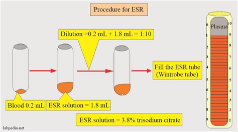 China Fast Detector Esr Tests Blood Tube Sand Rack Stand, 55% OFF