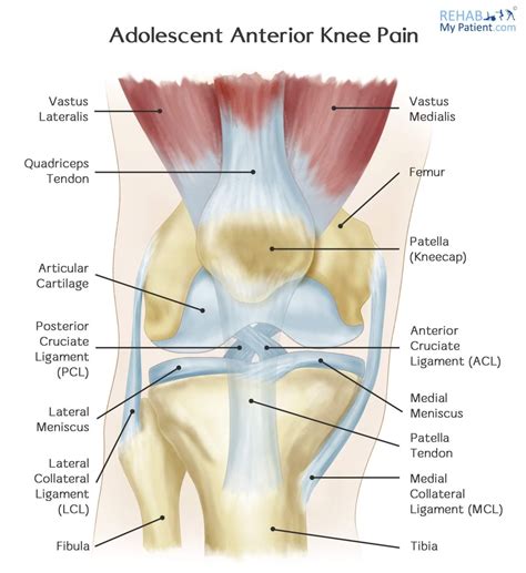 Adolescent Anterior Knee Pain | Rehab My Patient