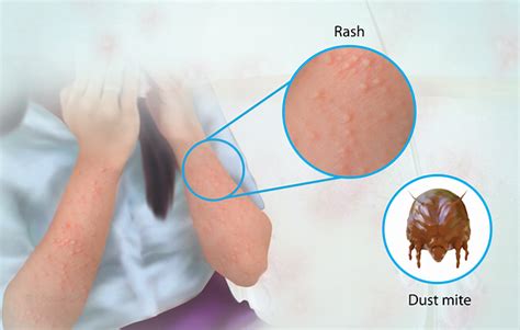 Health Condition : Symptoms, Causes, Treatment and More